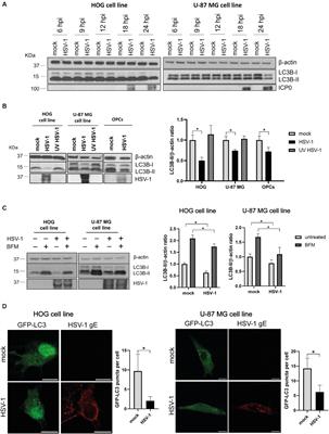 Herpes Simplex Virus type 1 inhibits autophagy in glial cells but requires ATG5 for the success of viral replication